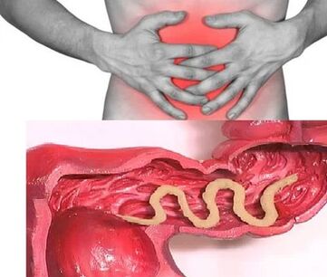 Human parasites